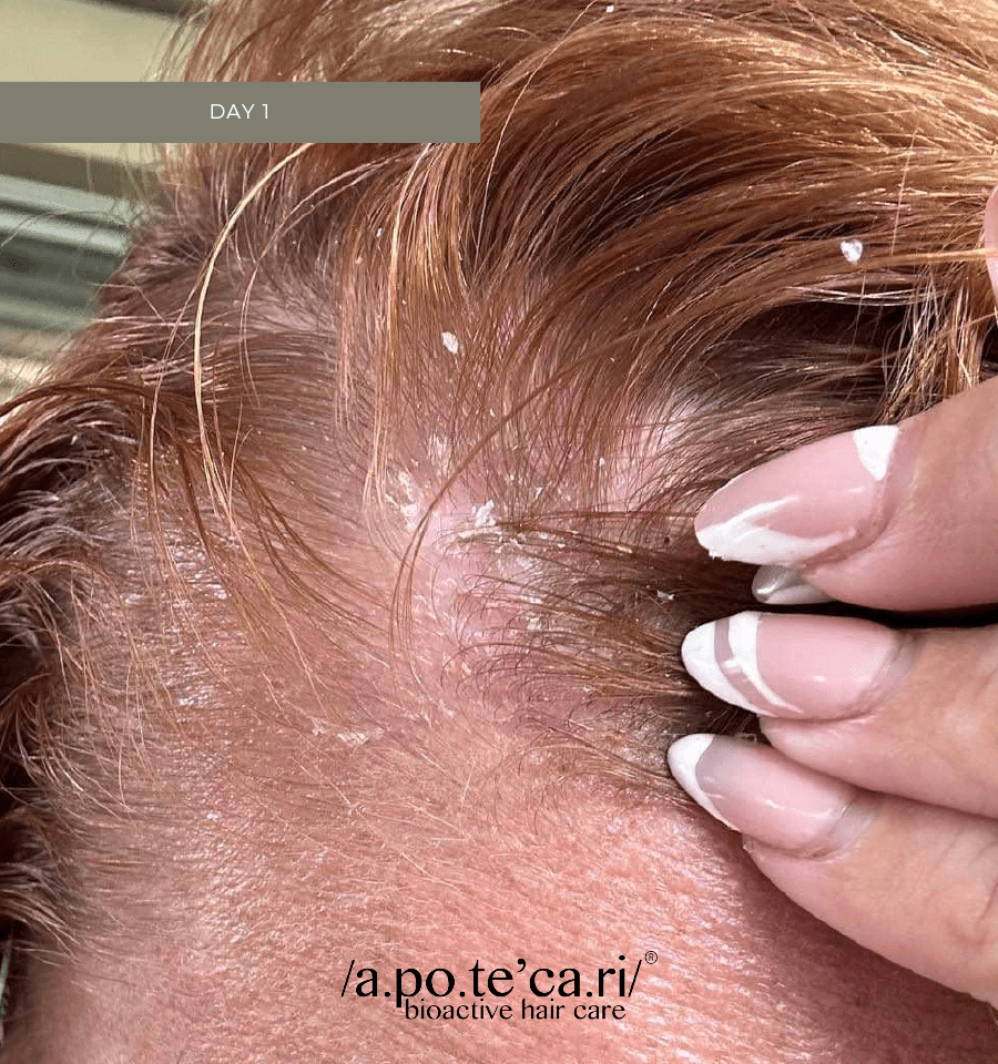 Apotecari, Crowning Glory, After, for healthy scalp