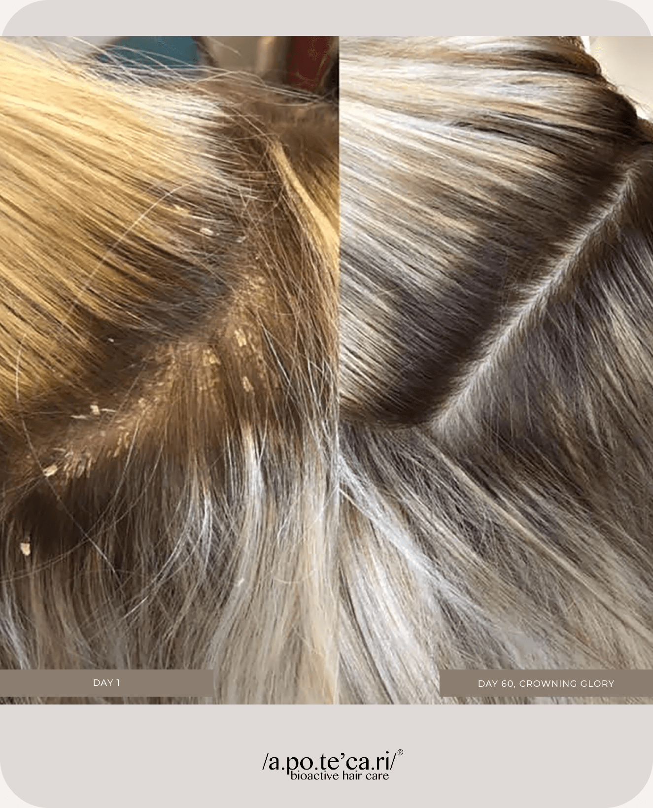 Apotecari, mane event, clowning glory, hair atelier, The complete trio, holistic, hair care, vegan, healthy hair, healthy scalp, thicker hair, testimonial, before and after, blonde, 30 days, 60 days, 90 days