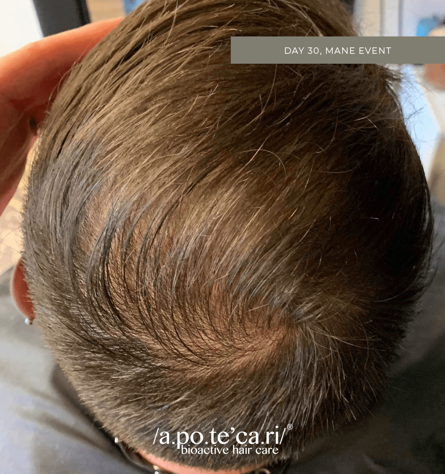 Apotecari for men, before and after