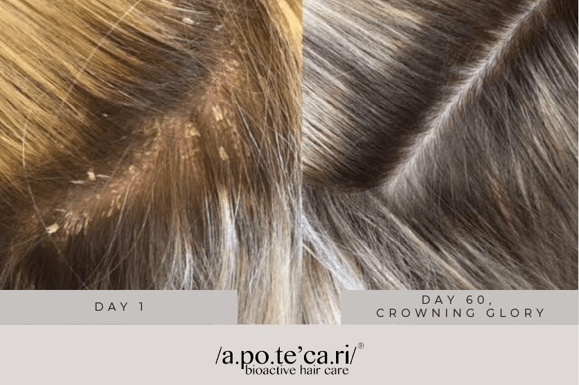 Apotecari, Mane Event, healthy hair, edible hair care, healthy, vegan, strong hair, longer hair, my hair analysis, quiz